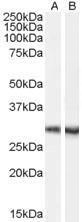 Staining of mouse brain lysate (35µg protein in RIPA buffer) with A) Anti-Dcdc2a Antibody (A84258) (0.1µg/ml) and B) Anti-DCDC2 Antibody (A84162). Primary incubation was 1 hour. Detected by chemiluminescence.