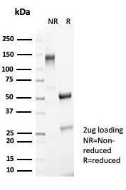 SDS-PAGE analysis of Anti-NeuN Antibody [NeuN/7071R] under non-reduced and reduced conditions; showing intact IgG and intact heavy and light chains, respectively. SDS-PAGE analysis confirms the integrity and purity of the antibody