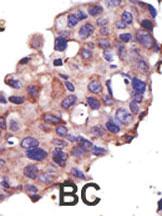 Anti-UBE2L3 Rabbit Polyclonal Antibody