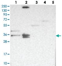 Anti-TMEM174 Rabbit Polyclonal Antibody