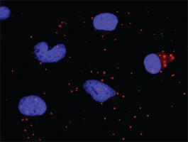 Anti-BCL2L1 + RAF1 Antibody Pair