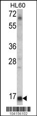 Anti-UBE2L6 Rabbit Polyclonal Antibody