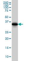 Anti-SPP1 Mouse Monoclonal Antibody [clone: 4H7]