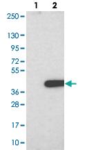 Anti-FAM212B Rabbit Polyclonal Antibody