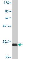 Anti-NCOR2 Mouse Polyclonal Antibody