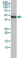 Anti-TARDBP Mouse Monoclonal Antibody [clone: 2E2-D3]