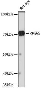 Western blot analysis of extracts of Rat eye, using Anti-RPE65 Antibody [ARC1659] (A308904) at 1:1,000 dilution The secondary antibody was Goat Anti-Rabbit IgG H&L Antibody (HRP) at 1:10,000 dilution Lysates/proteins were present at 25 µg per lane