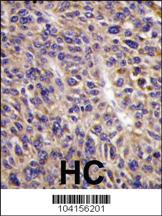 Anti-UBE2L6 Rabbit Polyclonal Antibody