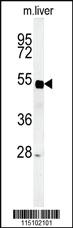 Anti-SP5 Rabbit Polyclonal Antibody [clone: 424CT5.1.6]