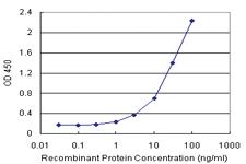 Anti-DNAI2 Antibody Pair