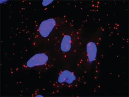 Anti-RXRA + RELA Antibody Pair