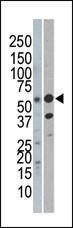 Anti-REL Rabbit Polyclonal Antibody (Biotin)