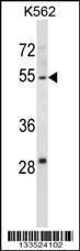 Anti-HYAL4 Rabbit Polyclonal Antibody (FITC (Fluorescein Isothiocyanate))