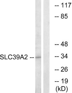 Western blot analysis of lysates from Jurkat cells using Anti-SLC39A2 Antibody. The right hand lane represents a negative control, where the antibody is blocked by the immunising peptide