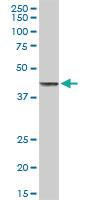 Anti-TNFRSF10B Rabbit Polyclonal Antibody