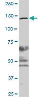 Anti-SMC3 Mouse Polyclonal Antibody