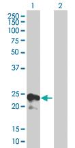 Anti-TIMP4 Mouse Polyclonal Antibody