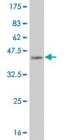 Anti-FOXC2 Mouse Monoclonal Antibody [clone: 3H5]