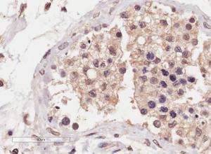 Antibody anti-SLC22A16 100 µg