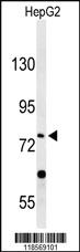 Anti-PLA2G6 Rabbit Polyclonal Antibody [clone: 422CT4.6.4]