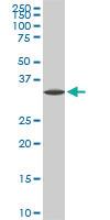 Anti-SPP1 Mouse Monoclonal Antibody [clone: 4H7]