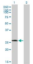 Anti-LRRK1 Mouse Polyclonal Antibody