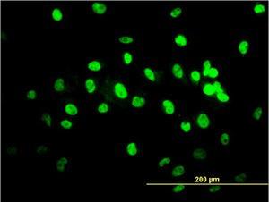 Anti-TARDBP Mouse Monoclonal Antibody [clone: 2E2-D3]