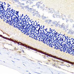 Immunohistochemistry analysis of paraffin-embedded rat retina using Anti-RPE65 Antibody [ARC1659] (A308904) at a dilution of 1:100 (40x lens) Perform microwave antigen retrieval with 10 mM Tris/EDTA buffer pH 90 before commencing with IHC staining protocol