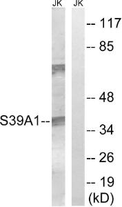 Anti-SLC39A1 antibody