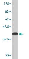 Anti-PRKCD Mouse Monoclonal Antibody [clone: 8E12]