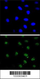 Anti-PTEN Rabbit Polyclonal Antibody (FITC (Fluorescein Isothiocyanate))