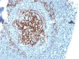 Immunohistochemical analysis of formalin-fixed, paraffin-embedded human tonsil using Anti-CD23 Antibody [FCER2/4395R]