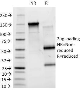 SDS-PAGE analysis of Anti-Blood Group Antigen B Antibody [HEB-20] under non-reduced and reduced conditions; showing intact IgG and intact heavy and light chains, respectively. SDS-PAGE analysis confirms the integrity and purity of the antibody.