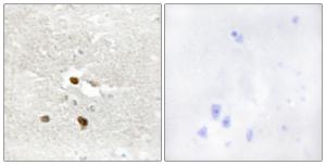 Immunohistochemical analysis of paraffin-embedded human brain tissue using Anti-ZNF287 Antibody. The right hand panel represents a negative control, where the antibody was pre-incubated with the immunising peptide