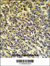 Anti-PLA2G6 Rabbit Polyclonal Antibody [clone: 422CT4.6.4]