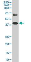 Anti-SPP1 Mouse Monoclonal Antibody [clone: 4H7]