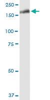 Anti-LRRK1 Mouse Polyclonal Antibody