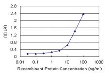 Anti-DNAI2 Polyclonal Antibody Pair