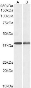 Anti-CAPG Antibody (A82704) (0.1µg/ml) staining of Mouse (A) and Rat Spleen (B) lysates (35µg protein in RIPA buffer). Primary incubation was 1 hour. Detected by chemiluminescence.