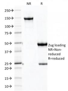 SDS-PAGE analysis of Anti-Cadherin 16 Antibody [CDH16/2125] under non-reduced and reduced conditions; showing intact IgG and intact heavy and light chains, respectively. SDS-PAGE analysis confirms the integrity and purity of the antibody.