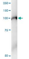 Anti-ILF3 Polyclonal Antibody Pair