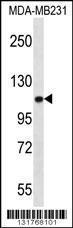 Anti-ACTN3 Rabbit Polyclonal Antibody (Biotin)