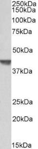 Anti-CAPG Antibody (A82704) (0.3µg/ml) staining of Pig Spleen lysate (35µg protein in RIPA buffer). Primary incubation was 1 hour. Detected by chemiluminescence.