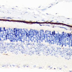 Immunohistochemistry analysis of paraffin-embedded mouse retina using Anti-RPE65 Antibody [ARC1659] (A308904) at a dilution of 1:100 (40x lens) Perform microwave antigen retrieval with 10 mM Tris/EDTA buffer pH 90 before commencing with IHC staining protocol