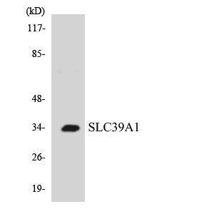 Western blot analysis of the lysates from COLO205 cells using Anti-SLC39A1 Antibody