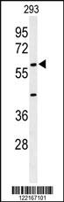 Anti-AMH Rabbit Polyclonal Antibody