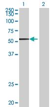 Anti-ADCK3 Mouse Polyclonal Antibody