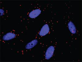 Anti-TRAF4 + TRAF6 Antibody Pair