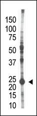 Anti-E2EPF Rabbit Polyclonal Antibody