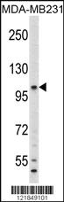 Anti-C6 Rabbit Polyclonal Antibody